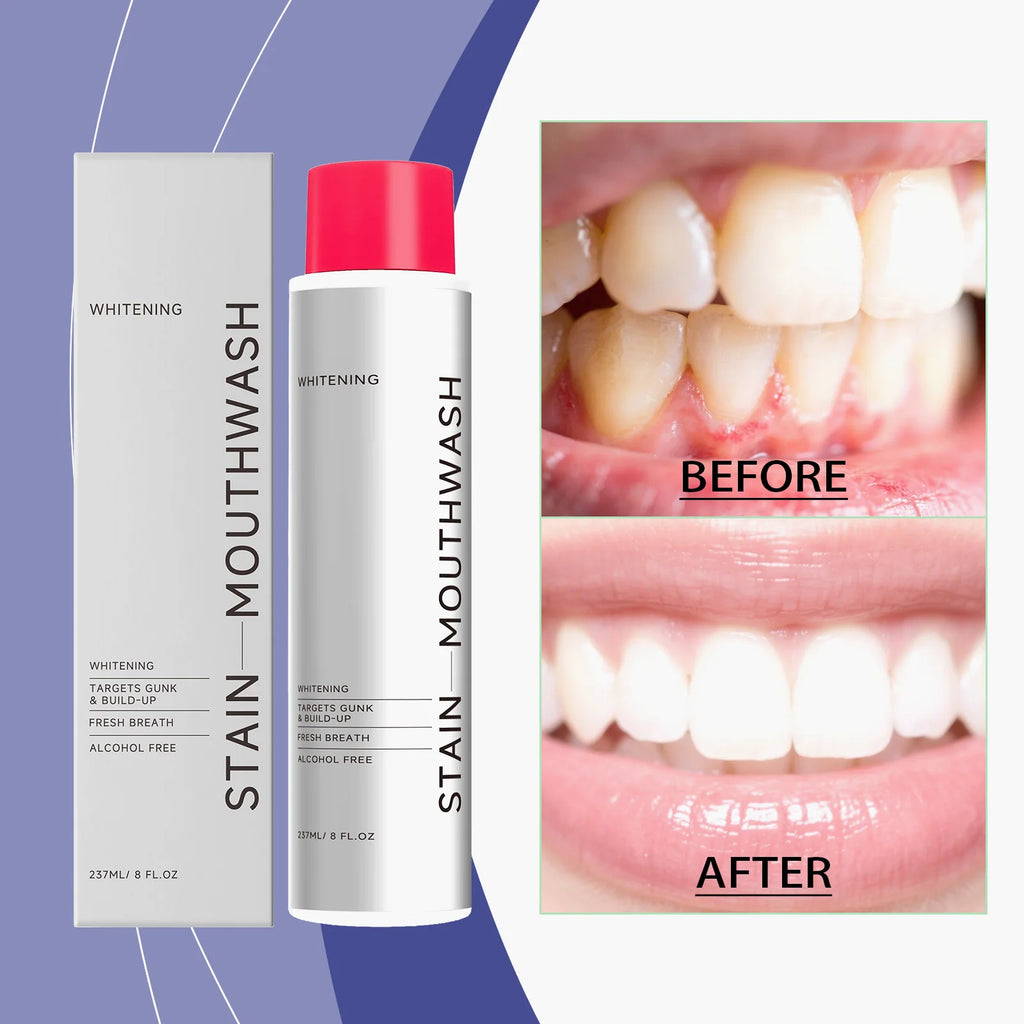 AMZ 237ml Mouthwash Is a Portable Daily Mouthwash That