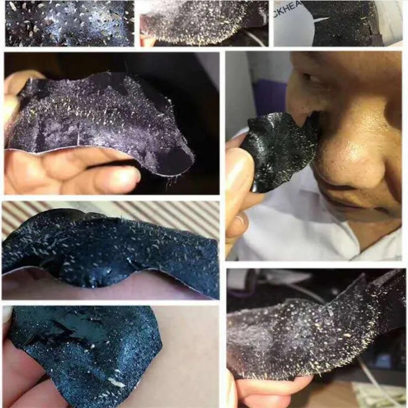 10-50pcs Nose Blackhead Remover Mask Deep Cleansing Skin Care Shrink Pore Acne Treatment Mask Nose Black dots Pore Clean Strips