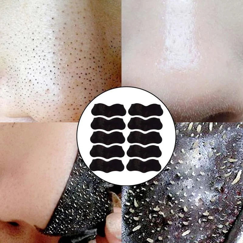 10-50pcs Nose Blackhead Remover Mask Deep Cleansing Skin Care Shrink Pore Acne Treatment Mask Nose Black dots Pore Clean Strips