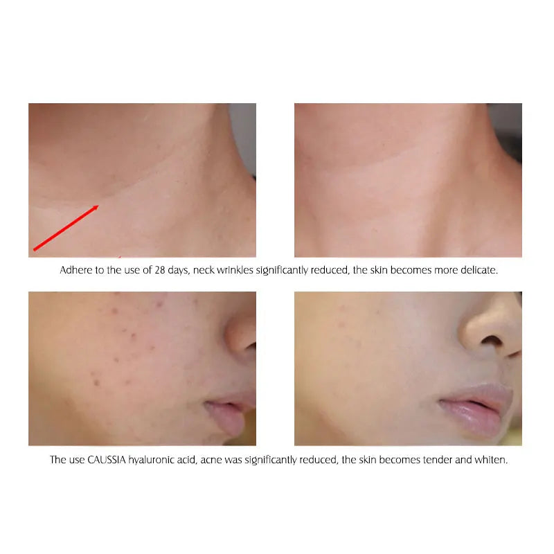 ARTISCARE Hyaluronic Acid Face Serum 5pcs for Moisturizing and  Brighten Long-Lasting Hydrating Skin Care Essence