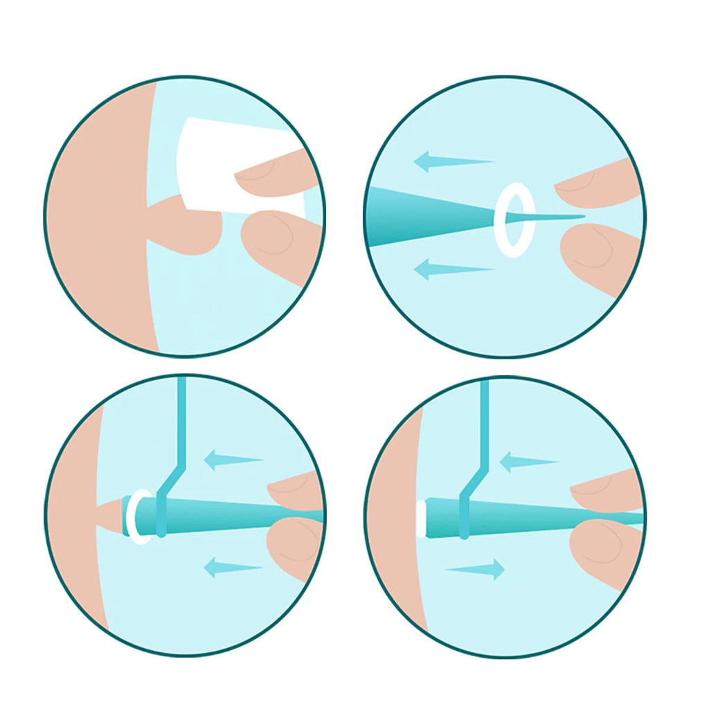 Micro skin tag remover Rubber bands for micro Skin tag wart Remove Acne remover Treatments Face Skin Care Good Tools
