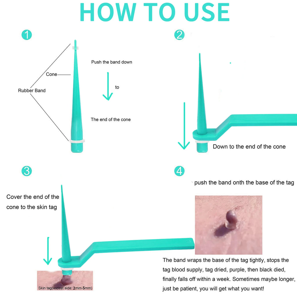 Micro skin tag remover Rubber bands for micro Skin tag wart Remove Acne remover Treatments Face Skin Care Good Tools