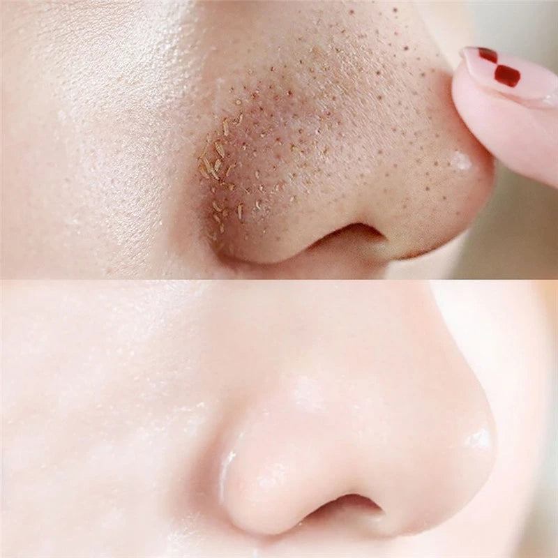 10-50pcs Nose Blackhead Remover Mask Deep Cleansing Skin Care Shrink Pore Acne Treatment Mask Nose Black dots Pore Clean Strips