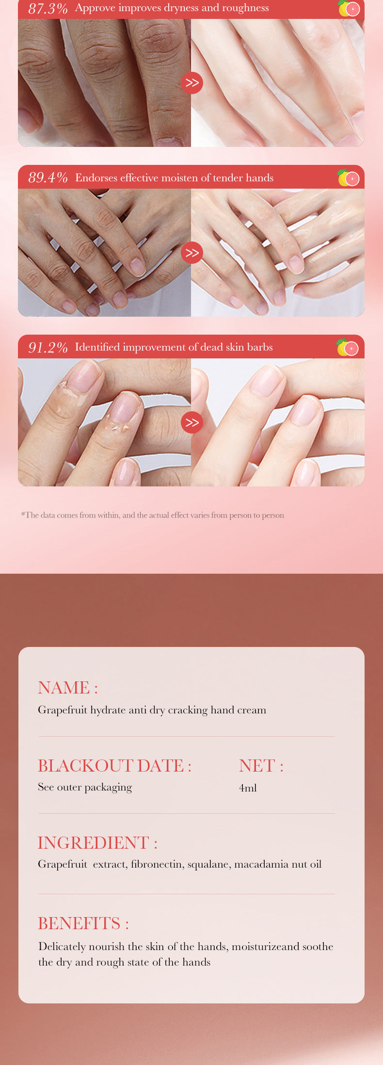 Wrinkle Removal Hand Cream Skin Soften Nourish Anti Drying Cracked Fade Fine Lines Whitening Moisturiz Repair Skin Care Products