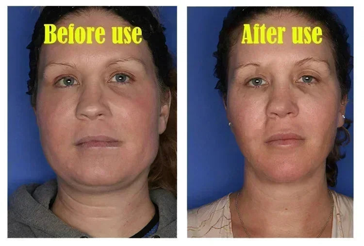 3RD  V-Shape Face Slimming Lifting Facial Cream Lift Up V Double Chin Cheek Slimming Firming Anti Wrinkle Beauty Skin Care