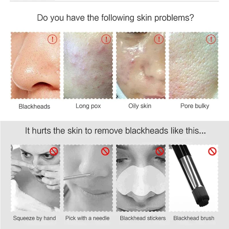 Electric Blackhead Remover Vacuum Suction USB Facial Pore Cleaner Spot Acne Pimple Black Head Extractor Face Clean Skin Care