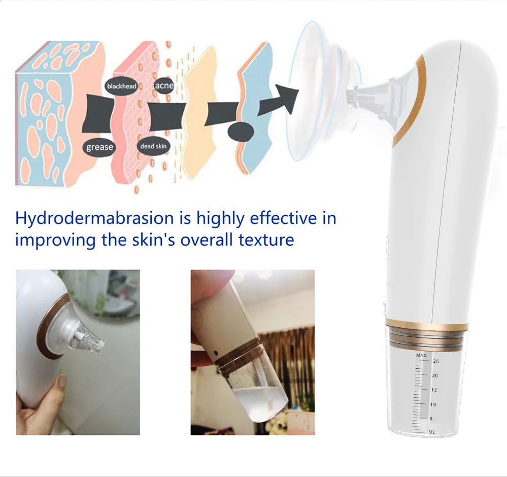 Small Bubble Blackhead Remover Machine Water Cycle Cleaning Blackheads Electric Deep Face Cleaning Skin Care Beauty Device