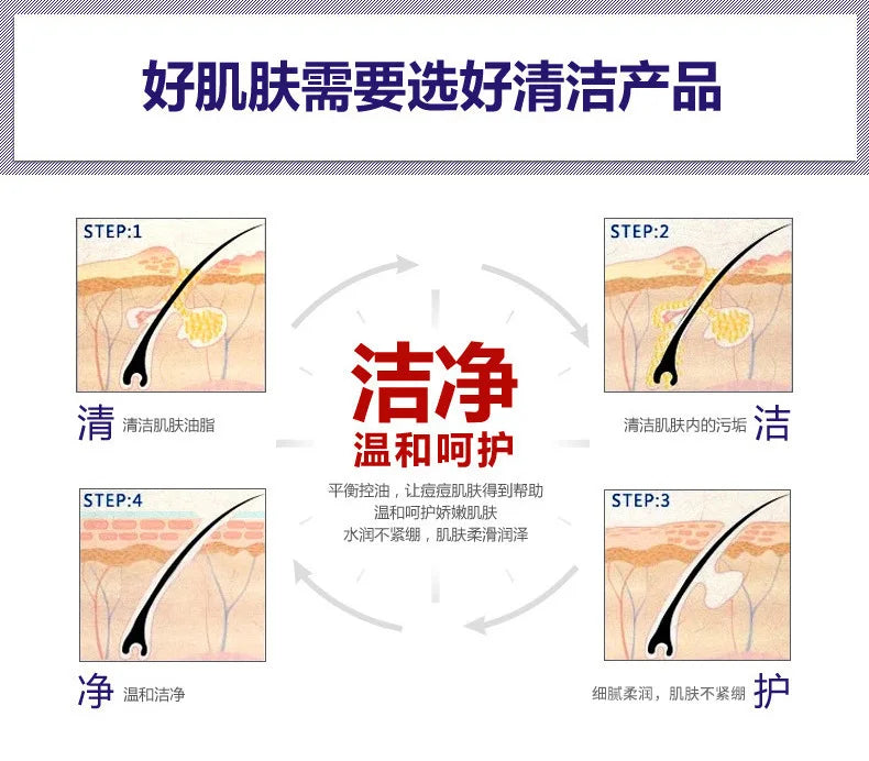 Treatment Cream Face Acne Remover Repair Gel Oil Control Serum Shrink Pores Whitening Facial mask Skin Care Korean Cosmetic