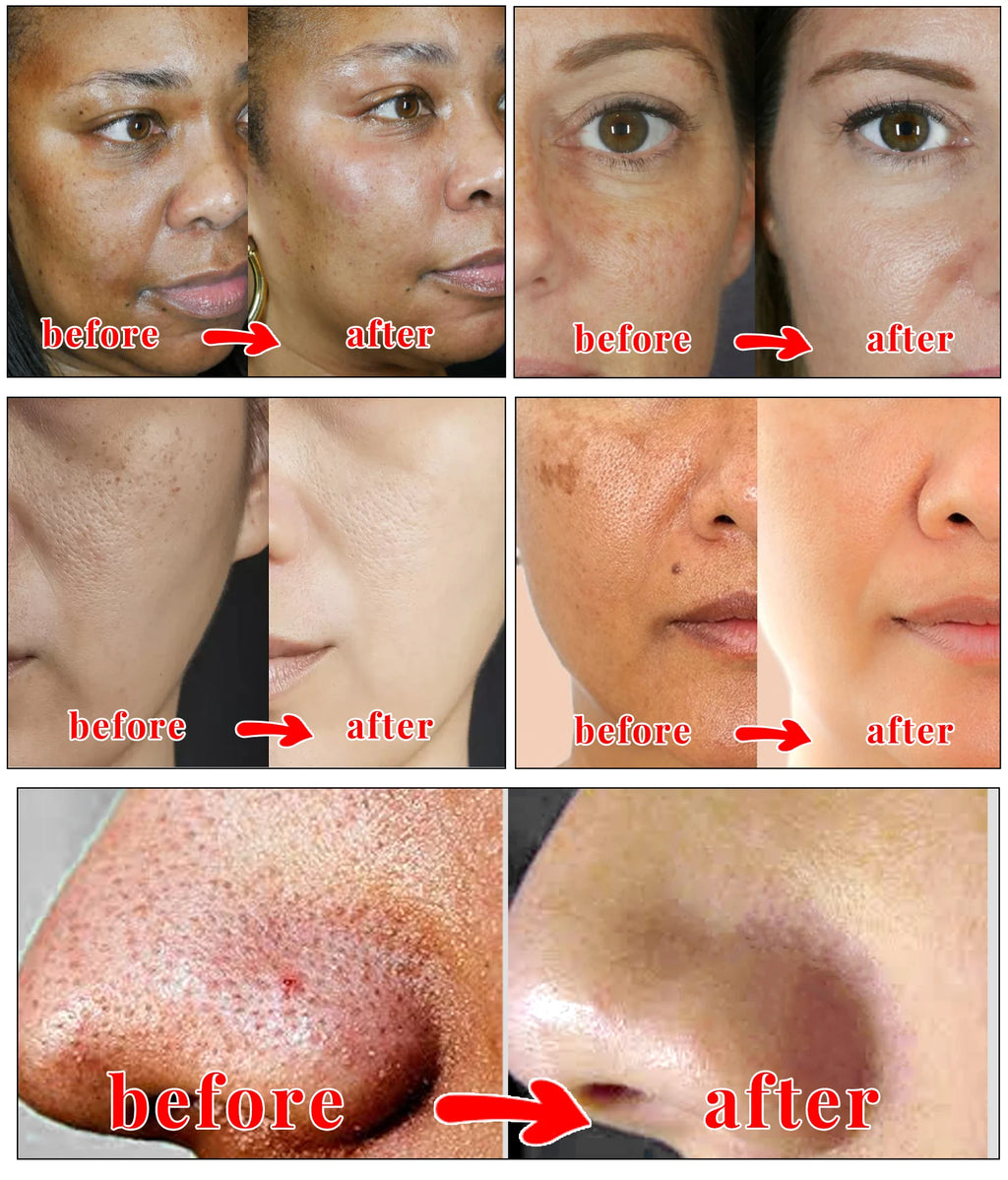 Kojic Acid Glow Soap Facial Deep Cleaning Even Skin Tone Skin Lightening Soap Oil Control Moisturizing Skin Care Soap for Men