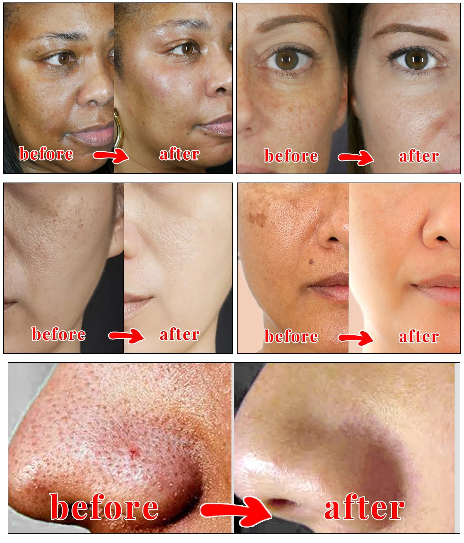 Kojic Acid Glow Soap Facial Deep Cleaning Even Skin Tone Skin Lightening Soap Oil Control Moisturizing Skin Care Soap for Men