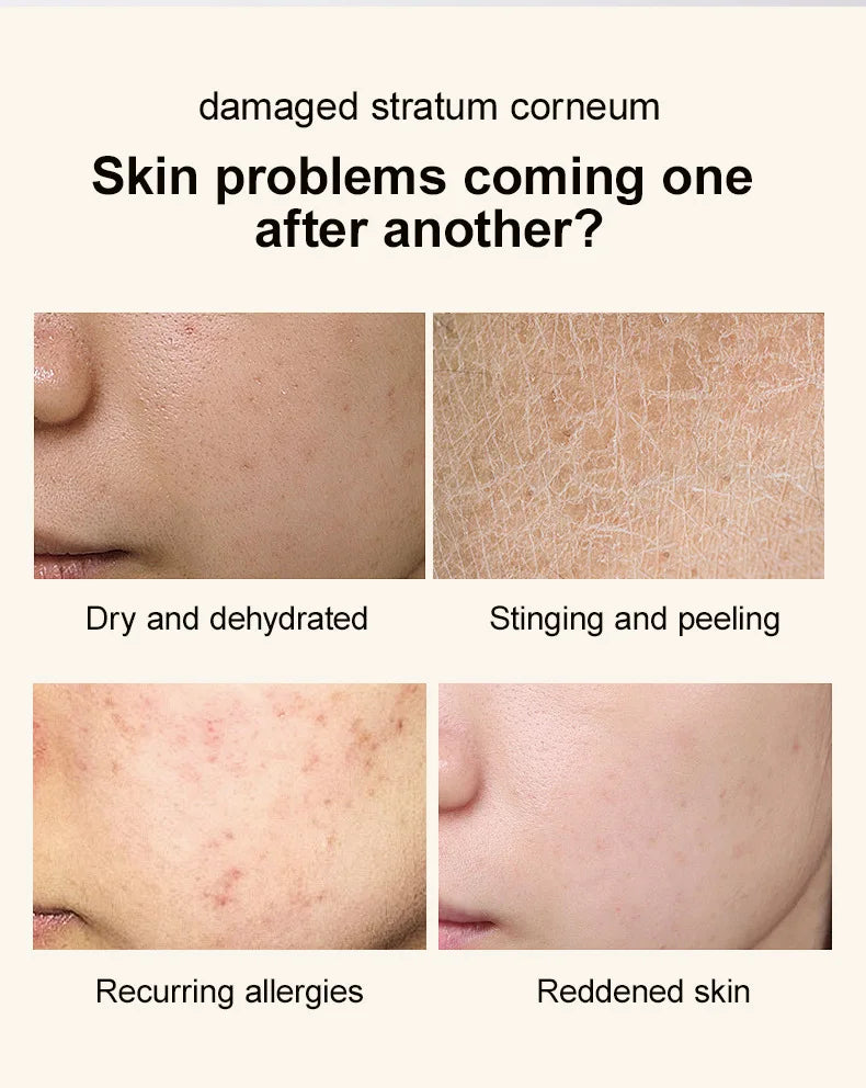 Madagascar Centella Asiatica Glow Essence Moisturizing Niacinamide Effective for Skin Care Pore Care for Sensitive Skin Ampoule