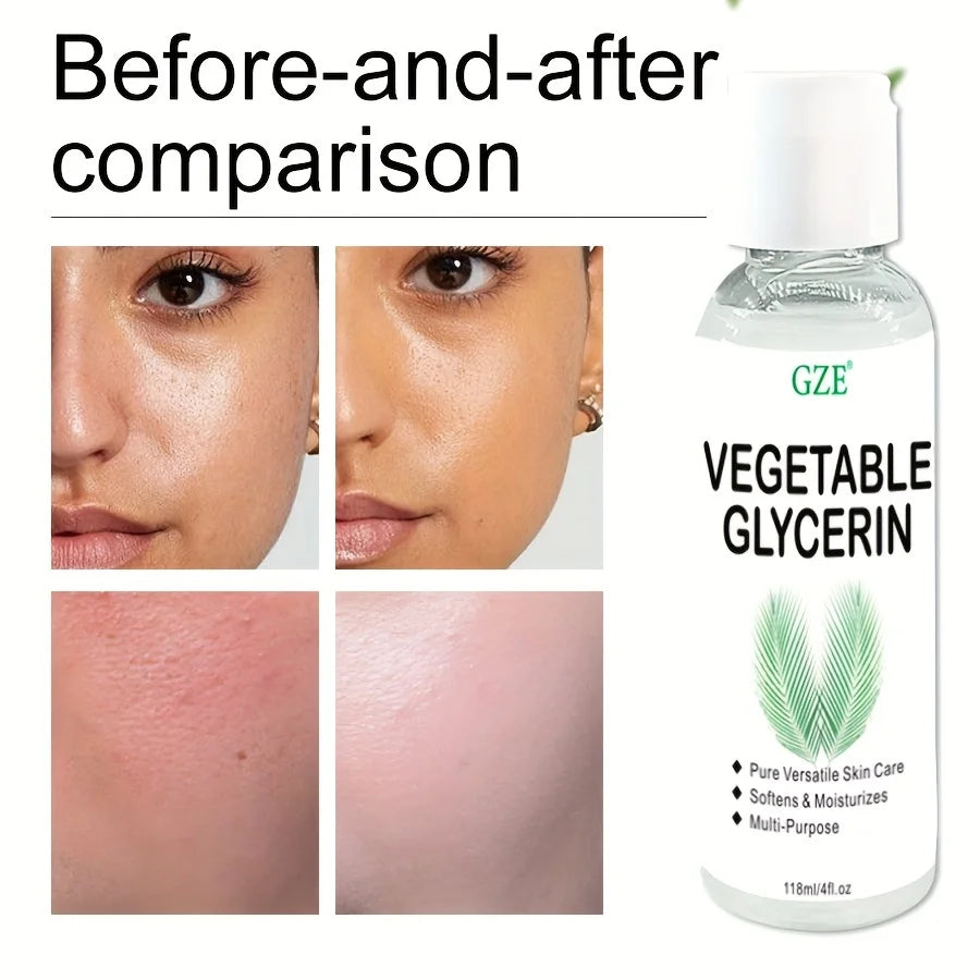 Vegetable Glycerin, 100% Pure, Versatile Skin Care, Softening and Moisturizing, Multi-PURPOSE AND VERSATILE SKIN CARE