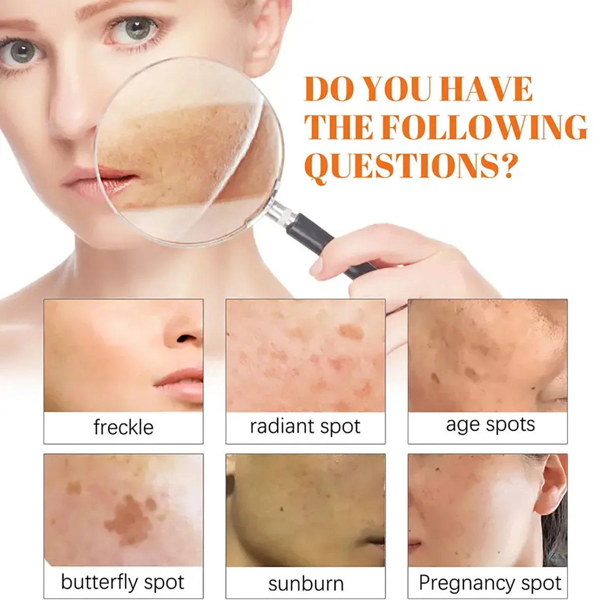 Moisturizing Rosehip Oil Oil Massage Skin Care Plant Essential Oil Moisturizing Whitening Essential Oil