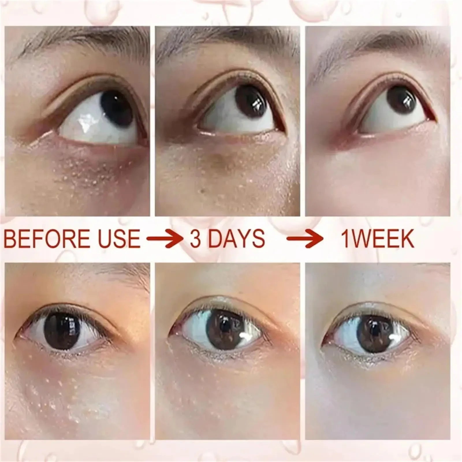 Fat Granules Removal Eyestick Anti-Puffiness Firming Cream Anti Inflammatory Fade Fine Line Repair Skin Barrier Korean Skin Care