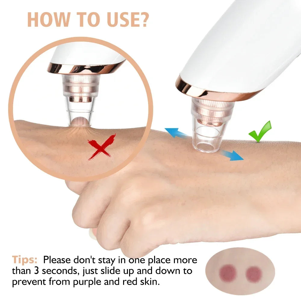 Electric Blackhead Remover Vacuum Suction USB Facial Pore Cleaner Spot Acne Pimple Black Head Extractor Face Clean Skin Care