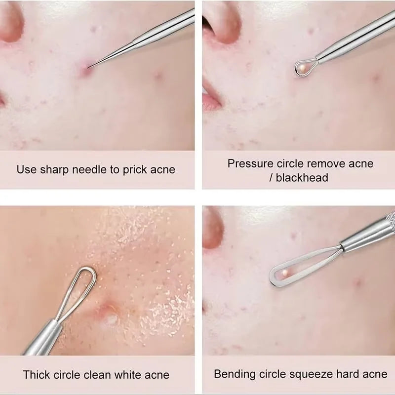 4pcs/8pcs /set Facial Pore Cleaner Spoon Blackhead Comedone Acne Pimple Blackhead Remover Tool Needles For Face Skin Care Tool