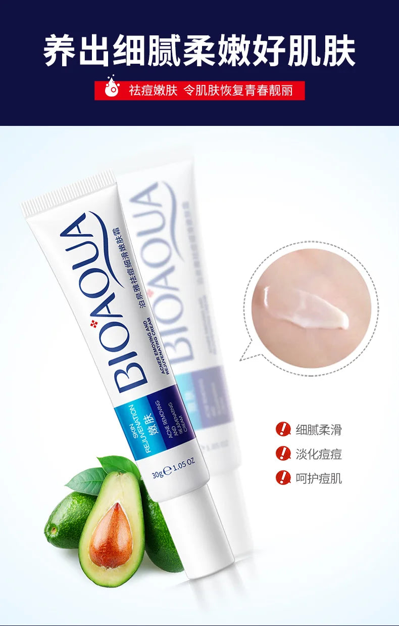 Treatment Cream Face Acne Remover Repair Gel Oil Control Serum Shrink Pores Whitening Facial mask Skin Care Korean Cosmetic
