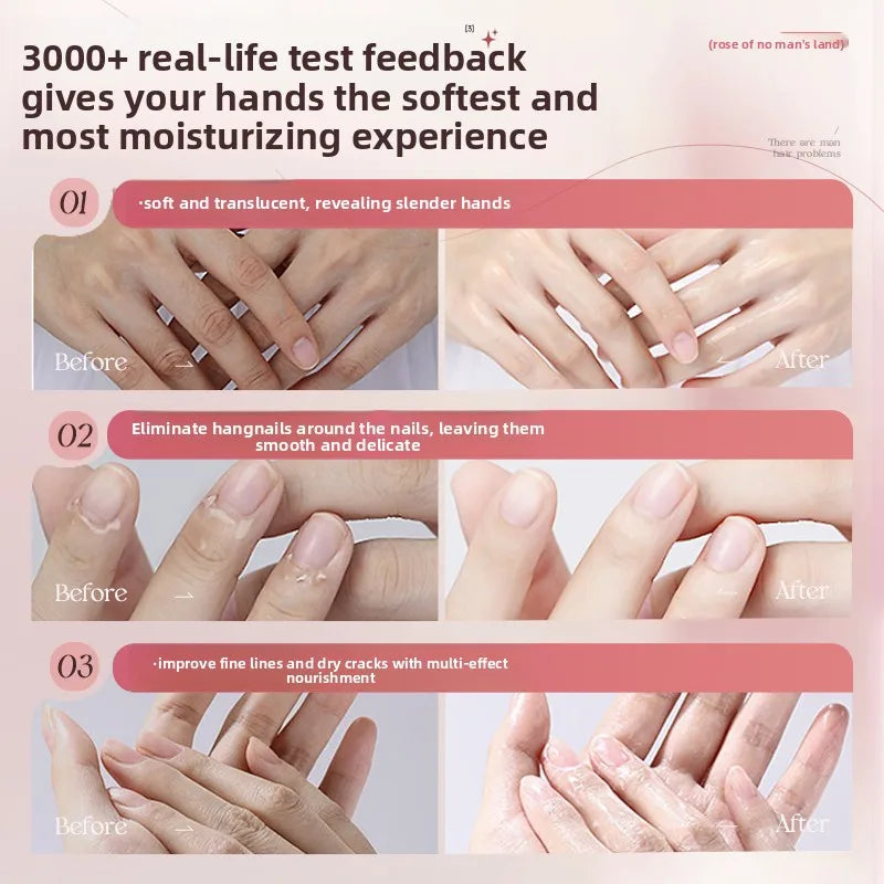 OHBT Moisturing Hand Care Oil, 150ml Rosehip Oil  Smooth Skin Care Essence, Whitening Nourish Hand Care Water
