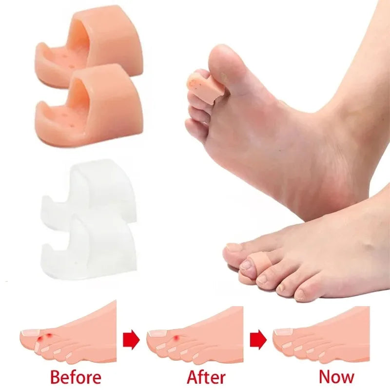 2/4PCS Hammer Toe Corrector Hammertoe Straightener for Curled Crooked Bent Claw and Overlapping Toes Bunion Pads Foot Care Tools