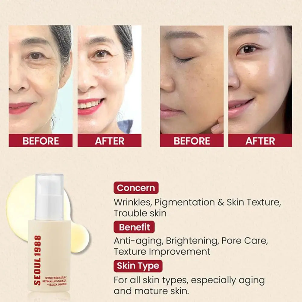 Korean SEOUL 1988 Serum Black Ginseng 2%Retinal Anti Aging Wrinkle Firming Pores Brightening Nicotinamide Balancing Skin Care