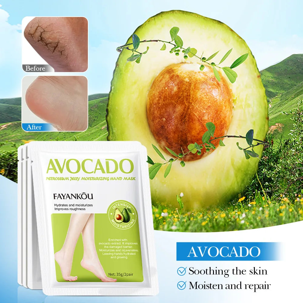 1/3/5 Pairs Avocado Exfoliating Foot Mask Feet Pedicure Remove Dead Skin Moisturizing Foot Exfoliator Feet Masks Skin Care