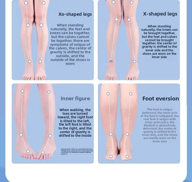 Insoles Unisex Orthopedic Insoles-Effective for Leg Shape Correction Overpronation/Supination Flat Feet O-Leg X-Leg&Arch Support