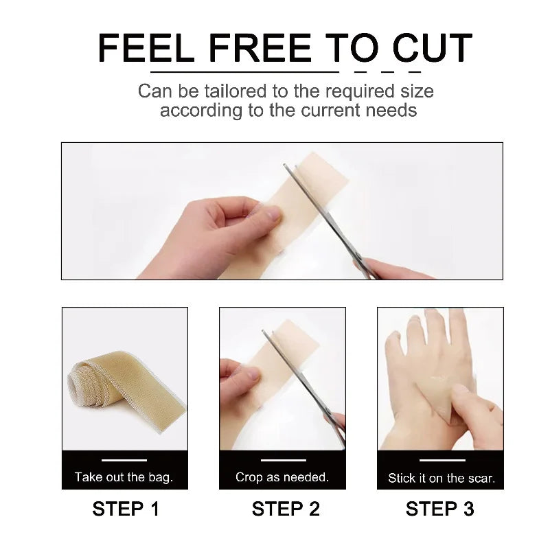 4CM x 3M Silicone Scar Sheets Self-Adhesive Stretch Mark Tape Scar Cover Patch Reusable and Effective Skin Care Strips