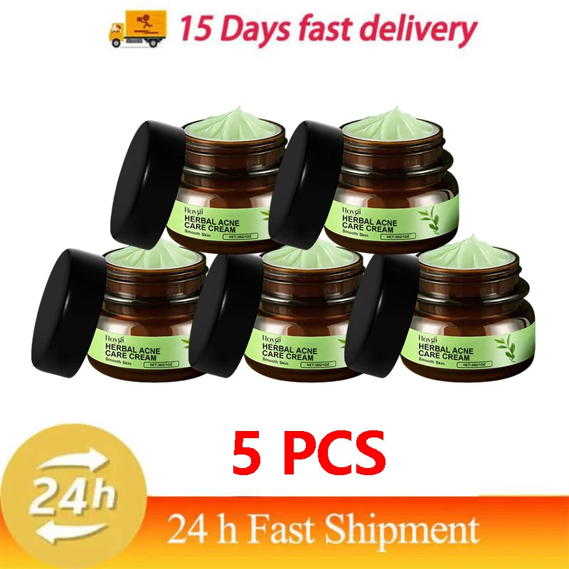 Natural Herbs Acid Acne Cream Shrink Pores Blackheads Scars Acne Marks Blemishes Oil Control Whitening Korean Skin Care Products