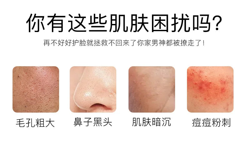Exfoliating Peeling Gel Facial Scrub Moisturizing Whitening Nourishing Repair Scrubs Face Cream Beauty Skin Care