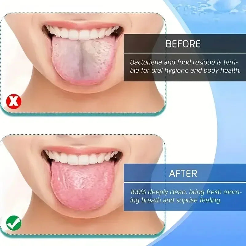 4 Colors Stainless Steel Tongue Scraper U-shaped Metal Fresh