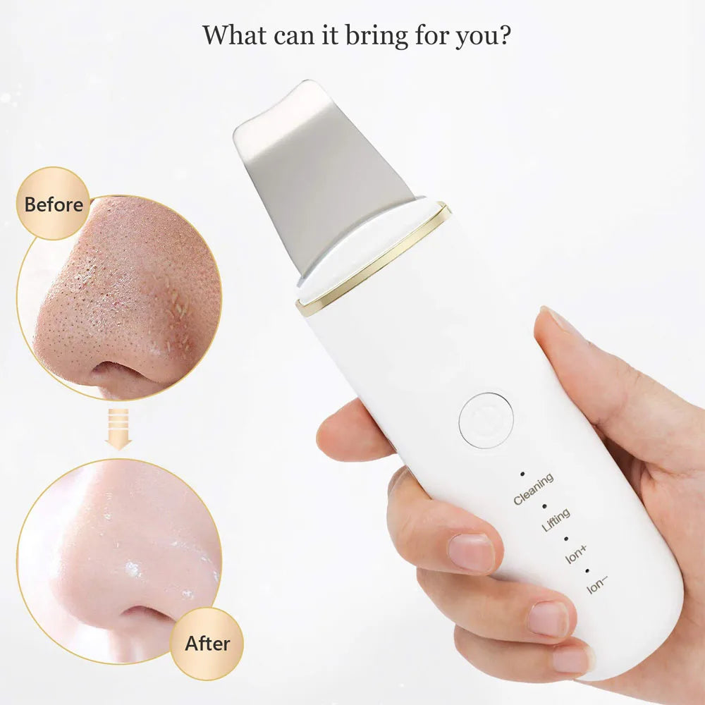 Ultrasonic Skin Scrubber Vibration Face Spatula Blackhead Remover Shovel Clean Cavitation Peeling Facial Lifting Skin Care
