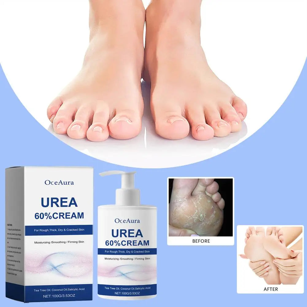 Urea Care Foot Cream Heel Repair Moisturizing Soft Relieve Drying Cracked Remove Calluses Dead Skin Removal Hand Foot Skin Care