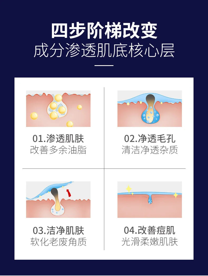 Treatment Cream Face Acne Remover Repair Gel Oil Control Serum Shrink Pores Whitening Facial mask Skin Care Korean Cosmetic