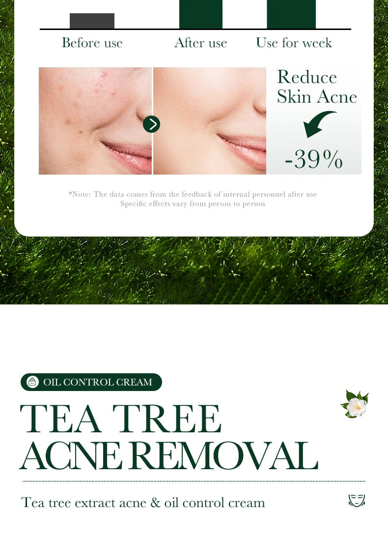 Tea Tree Acne Removing Cream Facial skincare Oil Control Face Gel Creams Hydrating Moisturizing Facial Cream Skin Care Set