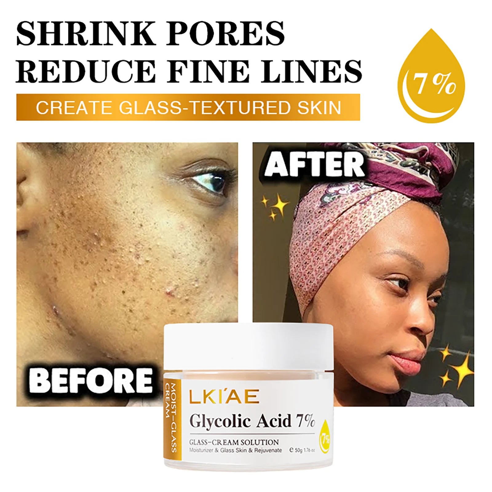 LKIAE Glycolic Acid Brightening Skin Care Set, Reduce Dark Spots, Unclog Pores, Clean Skin, Whitening Kit For All Skin Types