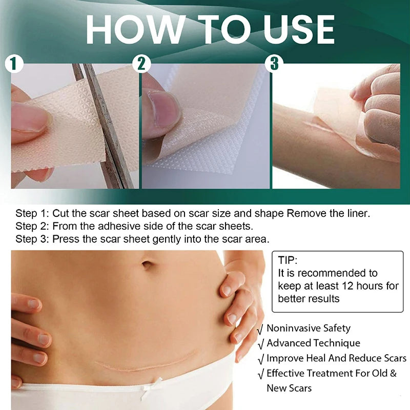 New 1 Roll Silicone Scar Sheets Gel Scar Patch 4cmX150cm Self-Adhesive Scar Cover Tape Reusable And Effective Skin Care Strips