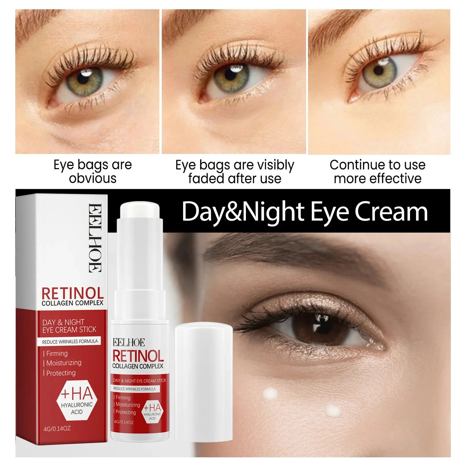 Fat Granules Removal Eyestick Anti-Puffiness Firming Cream Anti Inflammatory Fade Fine Line Repair Skin Barrier Korean Skin Care