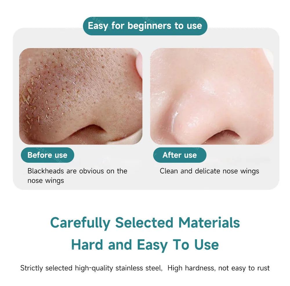 Double-Headed Acne Blackhead Removal Needles Stainless Steel Needle Remove Tools Face Skin Care Keratin Black Spot Pore Cleaner