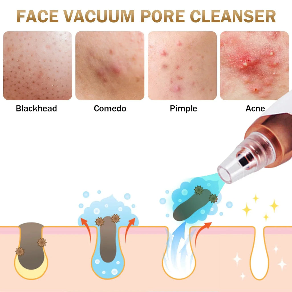 Electric Blackhead Remover Vacuum Suction USB Facial Pore Cleaner Spot Acne Pimple Black Head Extractor Face Clean Skin Care