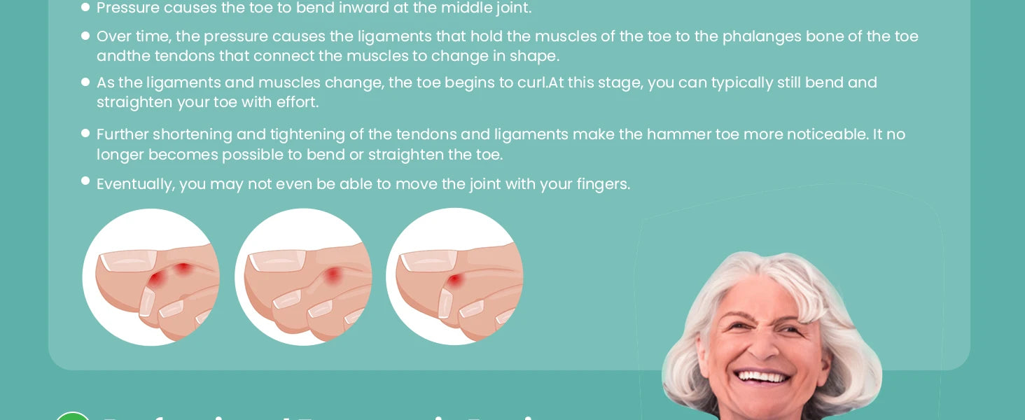 2Pcs Hammer Toe Straightener Gel Hammertoe Corrector for Curled Crooked Bent Claw Toes Lift Toe Tip Foot Care Tool Toe Cushion