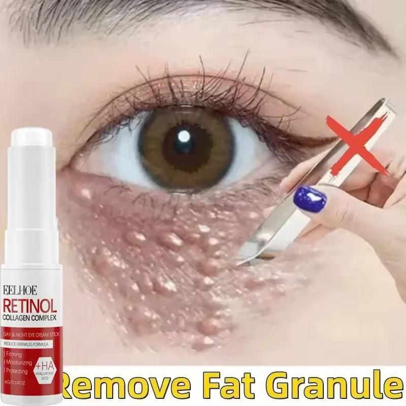Fat Granules Removal Eyestick Anti-Puffiness Firming Cream Anti Inflammatory Fade Fine Line Repair Skin Barrier Korean Skin Care