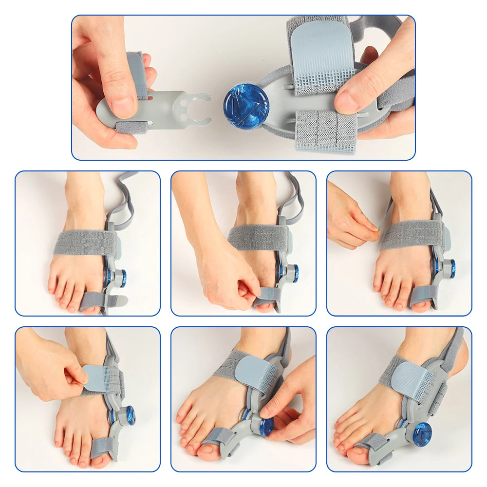 Bunion Splint Big Toe Straightener Hallux Valgus Correction Orthotics Foot Bone Thumb Adjuster Correction Bunions Corrector