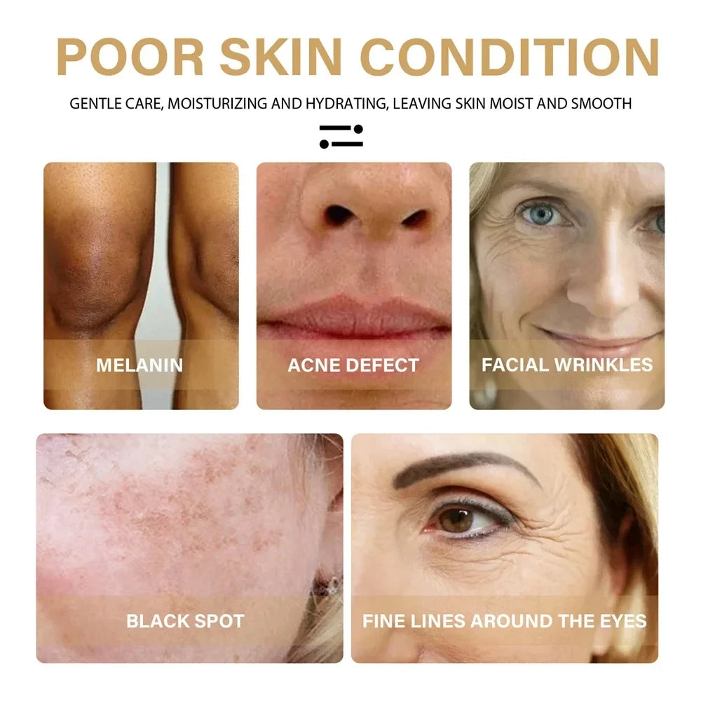 Turmeric Whitening Freckles Serum Remove Dark Spots Melasma Brighten Lighten Melanin Improve Dull Anti-aging Face Skin Care 10ml