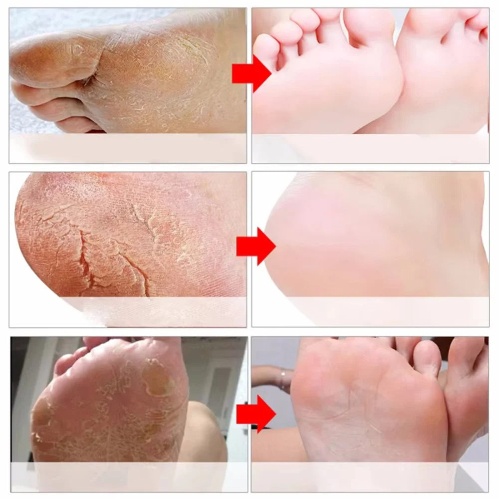 Exfoliating Foot Mask Feet Peeling Mask Spa Socks Smooth Dead Skin Remover Moisturizing Whitening Anti-Cracked Foot Skin Care