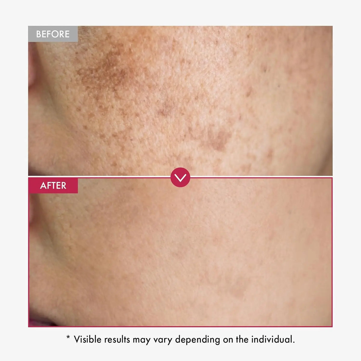 Alpha Arbutin Brightening Serum, Face and Body