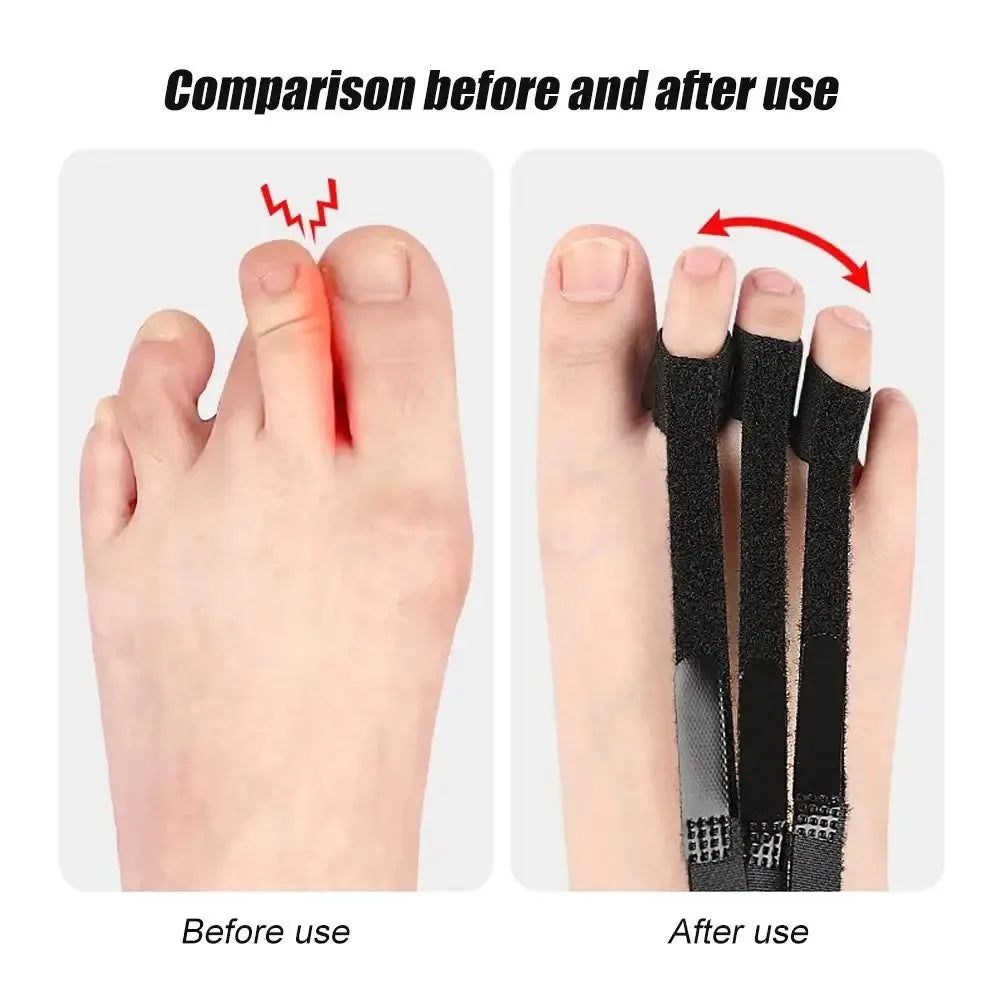 Hammer Toe Straightener Toe Stretcher Curled Toes Corrector Overlapping Toes Protector Sleeve Foot Pain Relief Soft Silicone
