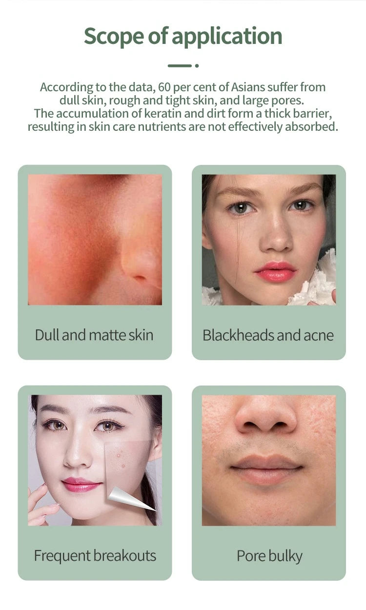 Facial Skin Scrubber Face Spatula Exfoliator Deep Cleansing Blackhead Remover Facial Lifting Cleaning Not Ultrasonic Skin Care