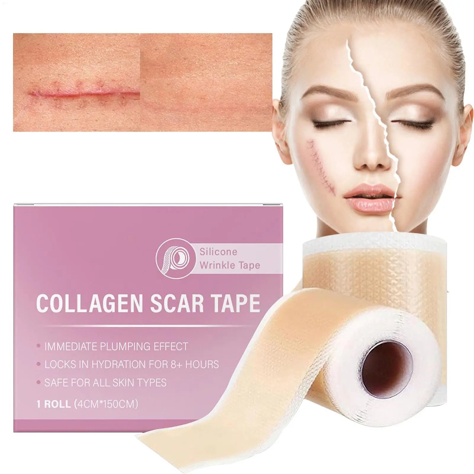 1 Roll Silicone Scar Sheets 4cmX150cm Self-Adhesive Scar Cover Tape Reusable and Effective Skin Care Strips Collagen Scar Tape