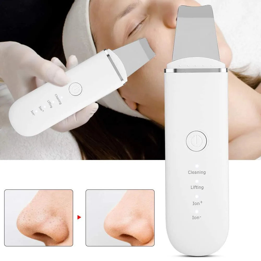 Ultrasonic Skin Scrubber Vibration Face Spatula Blackhead Remover Shovel Clean Cavitation Peeling Facial Lifting Skin Care