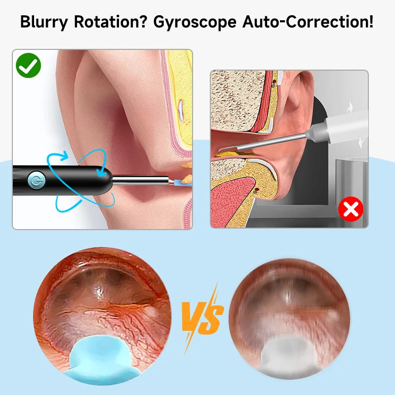 4.2MM Visual Ear Scope 1080P HD Otoscope Endoscope Ear